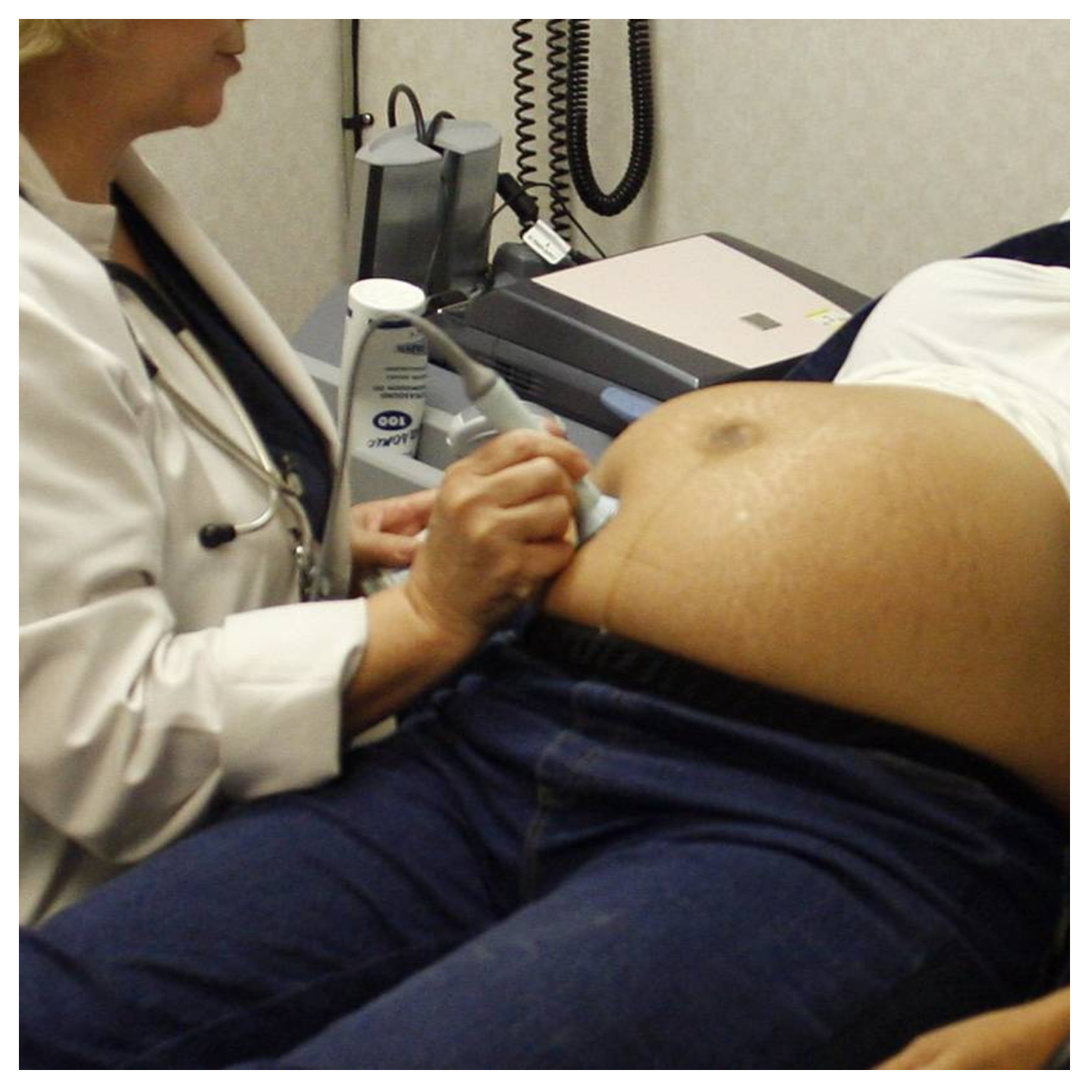 Health insurance should cover more than two scans for pregnant women —Experts