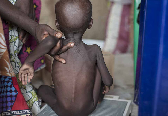 UN urges action against child malnutrition in Nigeria, 14 others