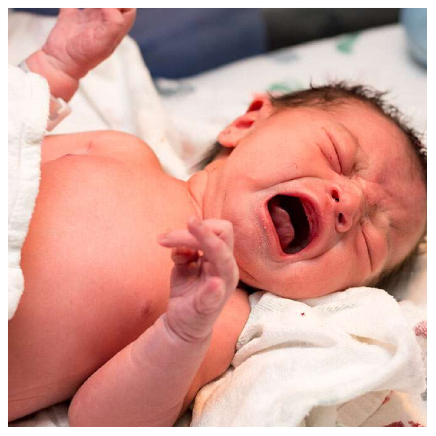 Paediatricians differ on newborns crying after delivery