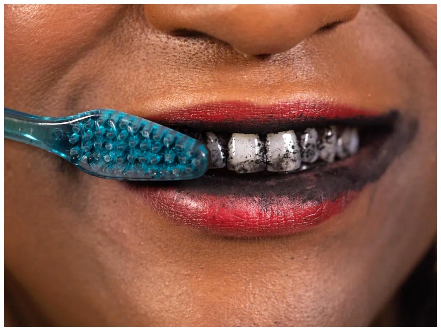 Whitening teeth with charcoal can cause mouth ulcer, decay- Experts warn 