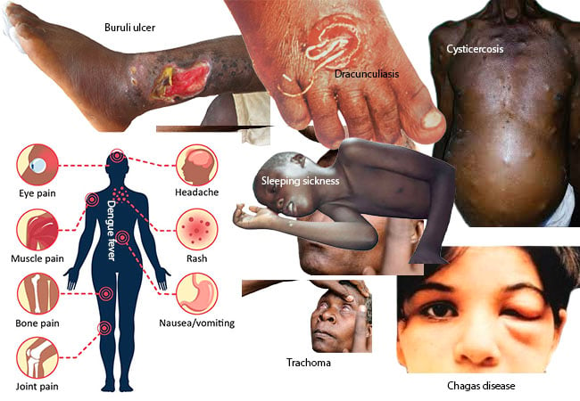 Market research findings to boost fight against tropical diseases – Parasitology professor